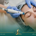 راهنمای جامع مراقبت‌های پس از لیزر و جراحی‌های پوستی