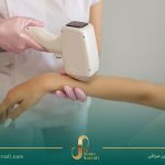 همه چیز درباره لیزر موهای زائد: راهنمای جامع