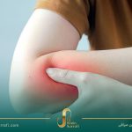 لیزر یا کرایوتراپی؟ مقایسه تخصصی دو روش درمانی