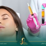لیزر درمانی در کنار PRP
