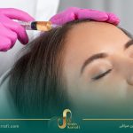 فیلر و بوتاکس یا PRP/LPRF