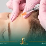 مراقبتهای بعد از تزریق PRP و LPRF