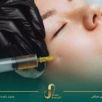 LPRF نسل جدید جوانسازی پوست