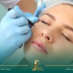 بوتاکس چیست؟